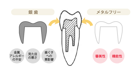 金属アレルギーについてイメージ1